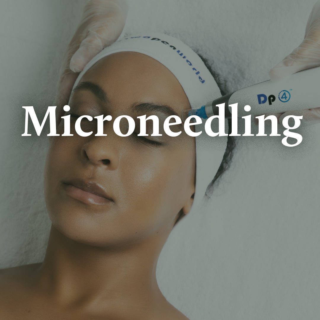Microneedling - Bellavera